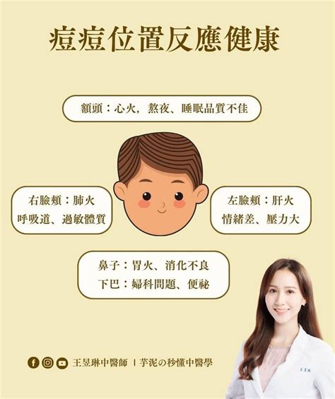 夫妻宮長痘痘|夫妻宮冒痘？婚姻運恐下滑